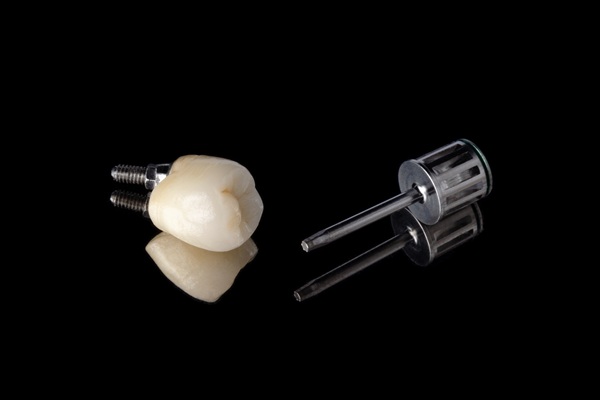 Tips For Implant Crown Care