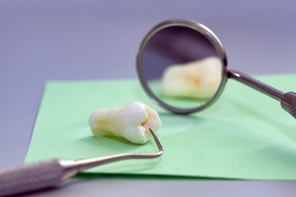 Tooth Replacement Options After A Tooth Extraction